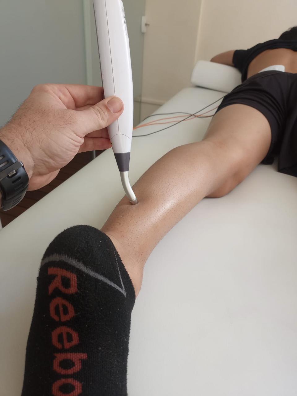 Tratamento com recurso eletrofísico na perna
